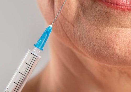 Qué cantidad de botox se debe aplicar?